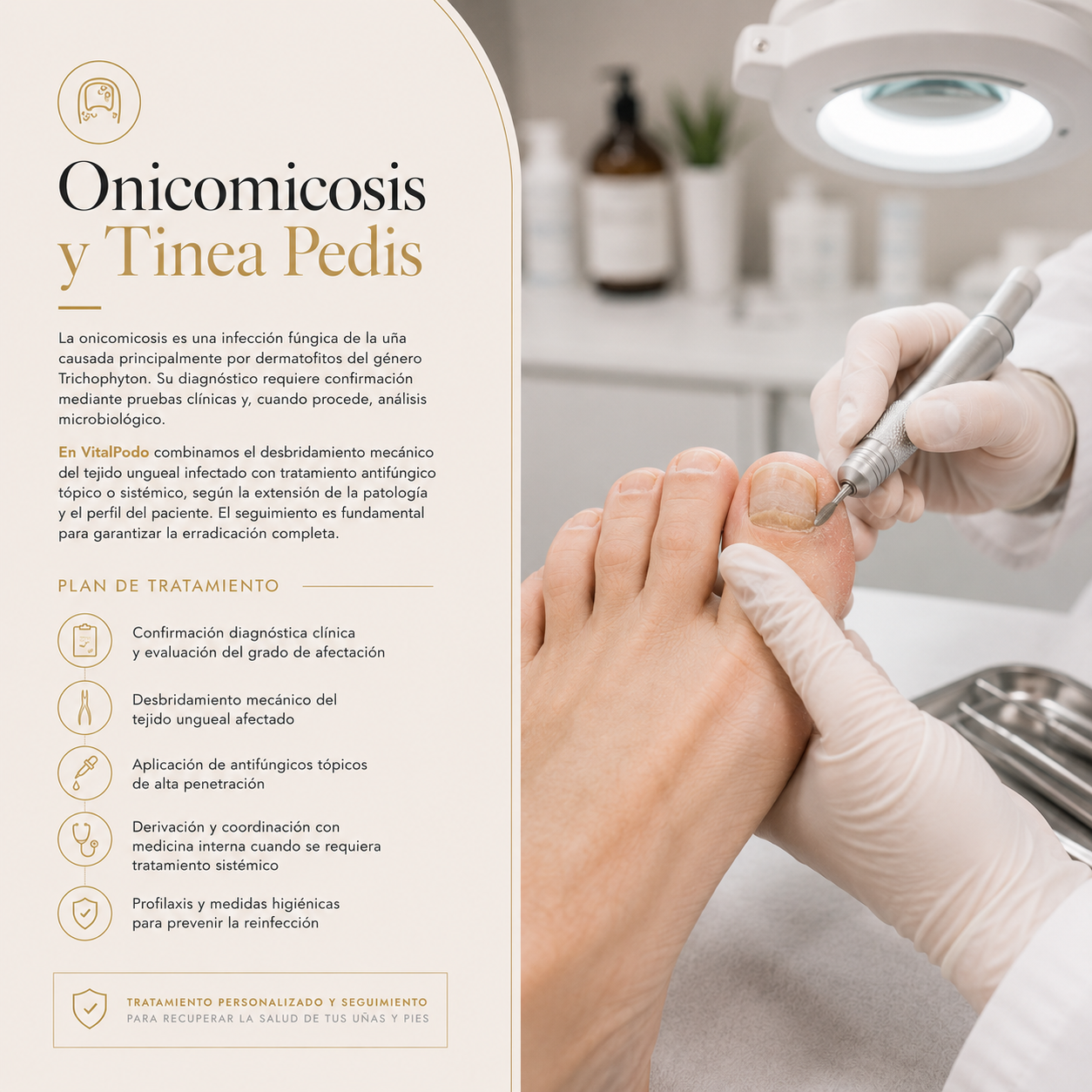 Onicomicosis